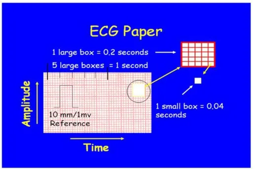 Gambar 6. EKG paper