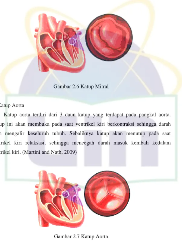 Gambar 2.6 Katup Mitral 