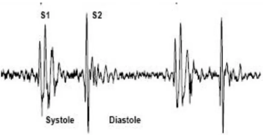 Gambar 2.3 Phonocardiogram Jantung (Debbal, 2009) 
