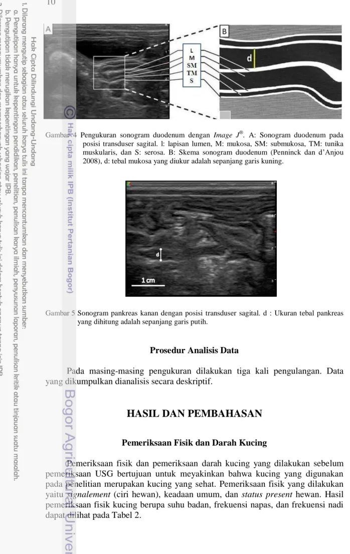 Gambar 5 Sonogram  pankreas  kanan  dengan  posisi  transduser  sagital.  d  :  Ukuran  tebal  pankreas  yang dihitung adalah sepanjang garis putih