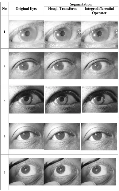 Tabel 1 - Hasil Segmentasi Iris Mata 