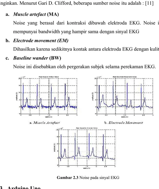 Gambar 2.3 Noise pada sinyal EKG 