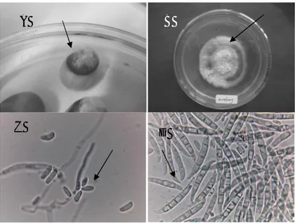 Gambar 2   : A = Penumbuhan Patogen pada kertas saring; B = Biakan Murni Fusarium  sp;    C =  mikrokonidia cendawan  Fusarium  sp dan      D  =    makrokonidia  Fusarium sp