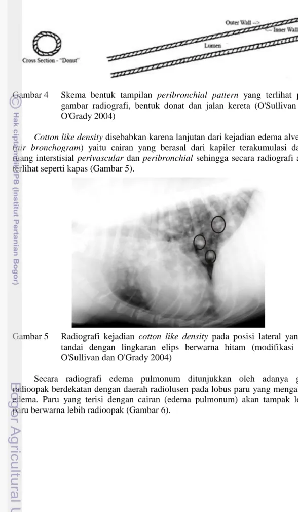 Gambar 4  Skema  bentuk  tampilan  peribronchial  pattern  yang  terlihat  pada  gambar  radiografi,  bentuk  donat  dan  jalan  kereta  (O'Sullivan  dan  O'Grady 2004) 