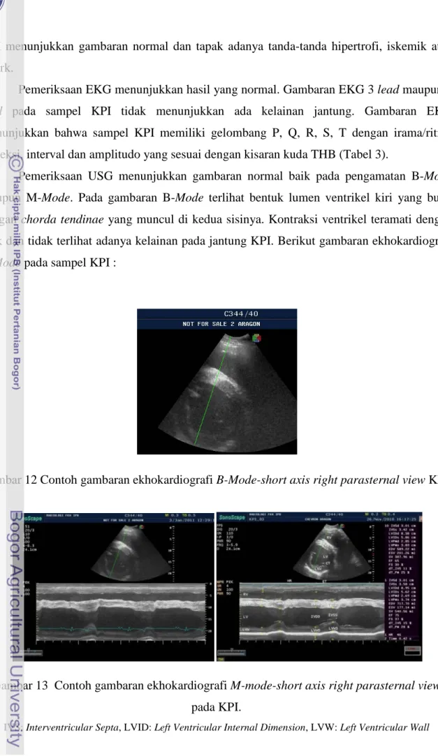 Gambar 12 Contoh gambaran ekhokardiografi B-Mode-short axis right parasternal view KPI