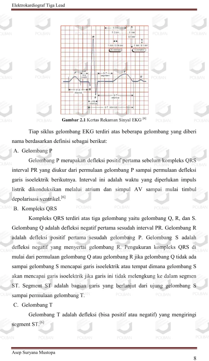 Gambar 2.1  Kertas Rekaman Sinyal EKG  [6]