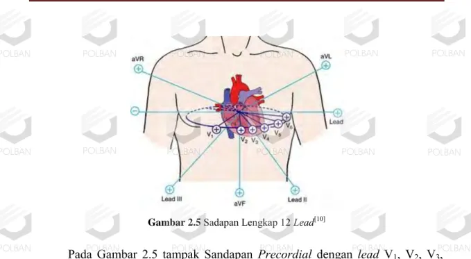 Gambar 2.5  Sadapan Lengkap 12 Lead [10] 