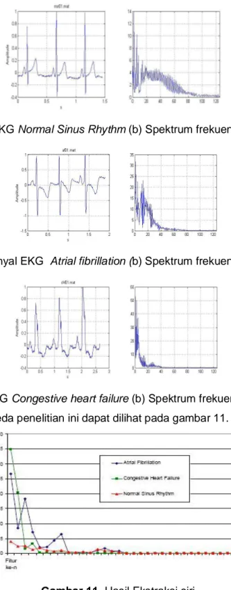 Gambar 8. (a) Sinyal EKG Normal Sinus Rhythm (b) Spektrum frekuensi Normal Sinus Rhythm 