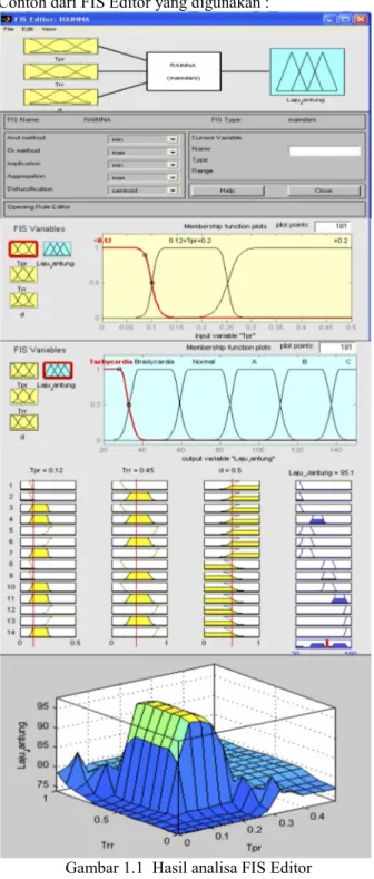 Gambar 1.1  Hasil analisa FIS Editor (MATLAB R2008a) Elektro Kardio Graf (EKG)