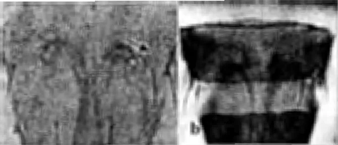 Gambar  10  Posisi  stenidia pada Tergit Abdomen  VIII  (a)  di Belakang Spirakel,  (b)  di Depan Spirakel 