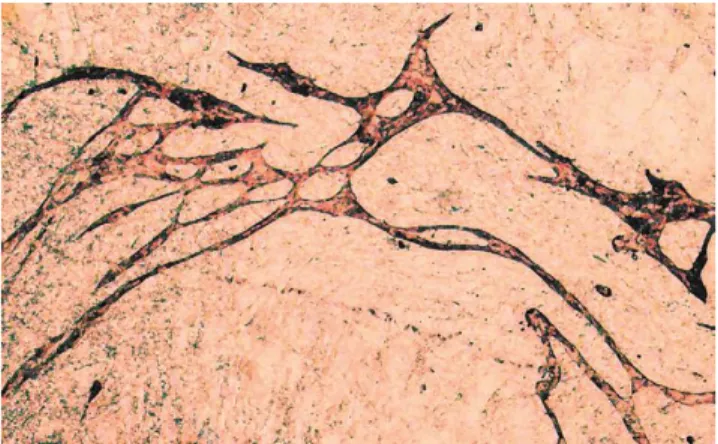Gambar 2.6.  Angiogenesis .  (Sharma, et al., 2001) 