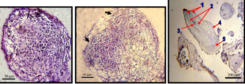 Gambar  4.  A.  Massa  sel  menyerupai  struktur  fase  globular  (Globular-  like  structure)  B
