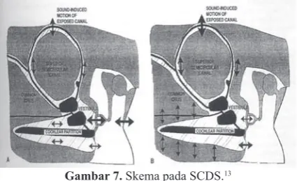 Gambar 7. Skema pada SCDS.13