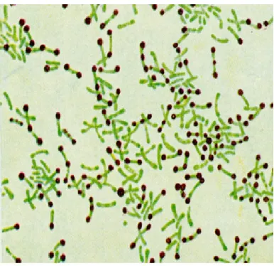Gambar 3. Sel Corynebacterium pada pewarnaan gram.15