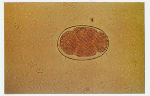 Gambar 2.4.1 Telur Cacing Tambang (Hadidjaja.P, Srisasi G, 2002) 