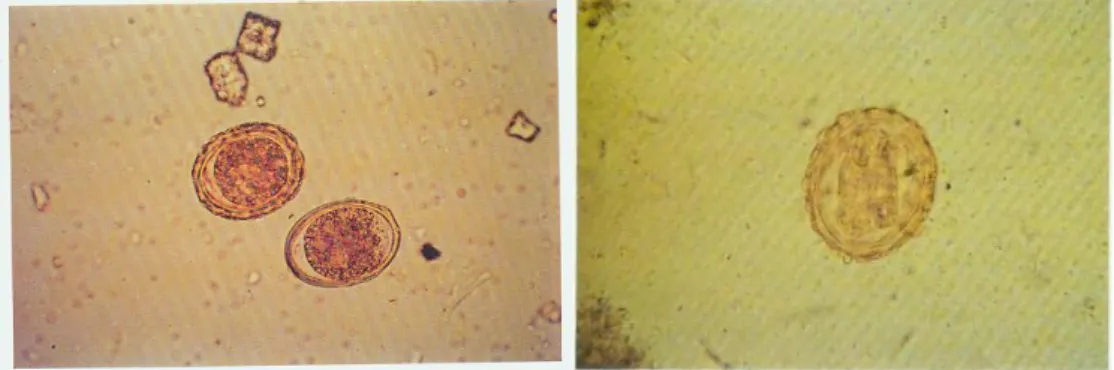 Gambar 2.1.1 Telur Ascaris lumbricoides   (Hadidjaja.P, Srisasi G, 2002) 
