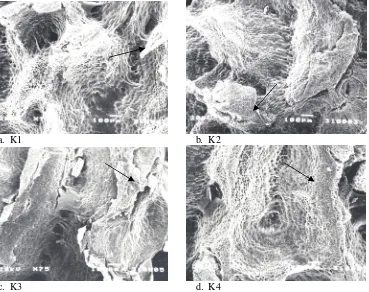 Gambar 2. Foto scanning electron microscopy perbesaran 75x pada testa benih pepaya dari berbagai metoda 