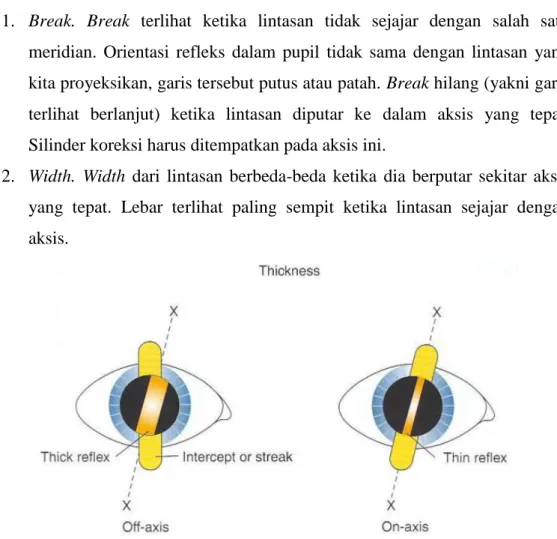 Gambar 6. Width/ lebar atau ketebalan, refleks retina. Kita tentukan  lokasi aksis di tempat dimana refleks paling tipis 9