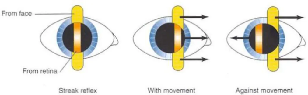 Gambar 3. Gerakan refleks retina. Perhatikan grakan lintasan dari wajah dan  dari retina dalam gerakan searah versus gerakan berlawanan 9