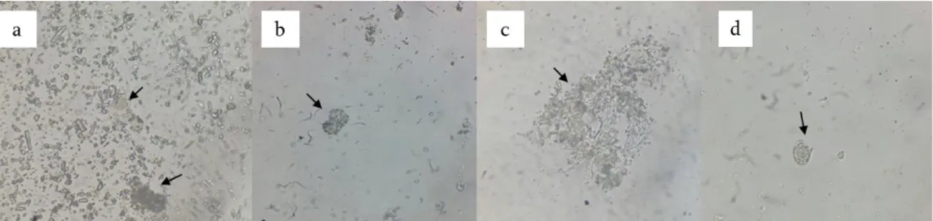 Gambar 1.  Konidia  Peronosclerospora  spp.  yang  mengalami  kerusakan  akibat  perlakuan  fungisida  metalaksil  (a),  dimetomorf  (b),  fenamidon  (c)  dan  konidia  yang  berkecambah  pada  perlakuan  fungisida metalaksil (d)