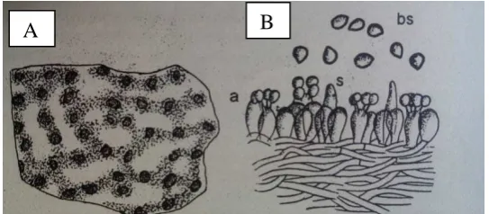 Gambar 1 Struktur Mikrokopis (A). R. microporus (B). Basidium (a), basidiospora, (bs), sistidium (s), (Semangun, 2000)  
