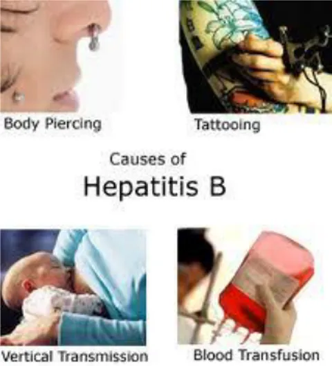 Gambar 2. Penularan Hepatitis B 