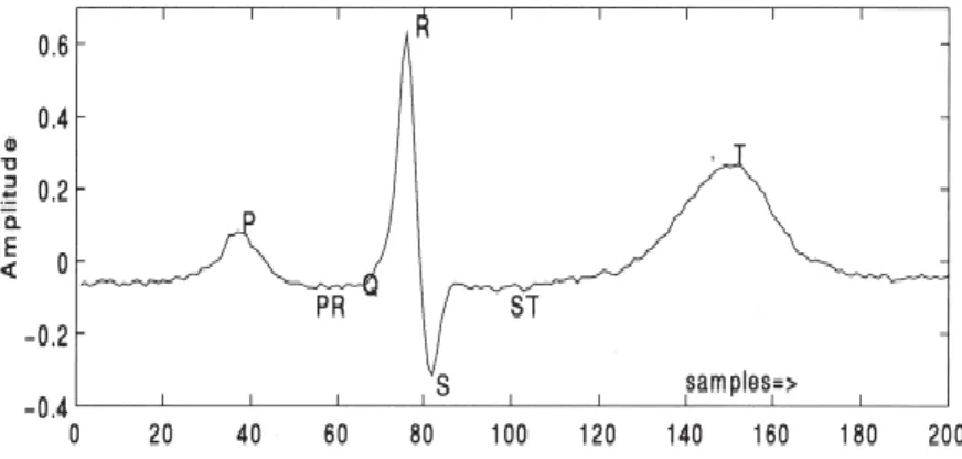 Gambar 1.Ilustrasi sinyalelektrokardiogramdenganfitur-fiturmorfologinya [1]. 