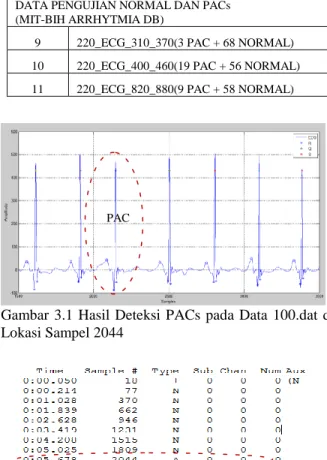 Gambar  3.1  Hasil  Deteksi  PACs  pada  Data  100.dat  di  Lokasi Sampel 2044 