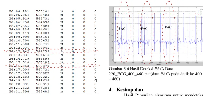 Gambar 3.6 Hasil Deteksi PACs Data 