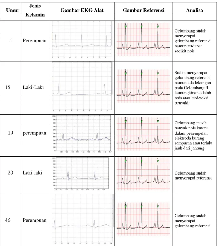 Tabel 2. Data EKG Beberapa Pasien Dengan Umur Yang Berbeda  Umur  Jenis 