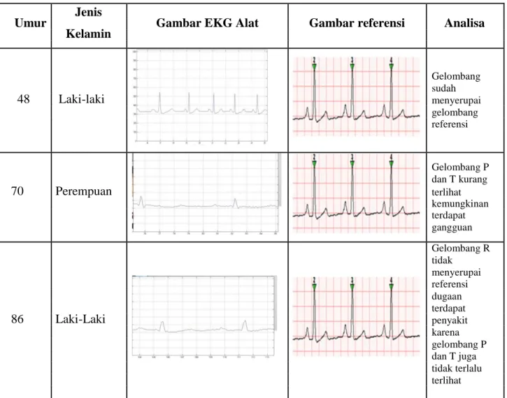 Tabel 2. Data EKG Beberapa Pasien Dengan Umur Yang Berbeda (lanjutan)  Umur  Jenis 