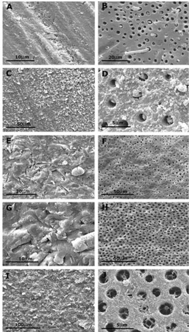 Figure 1. SEM images of dentin treated with: (A) diamond rotaryinstrument (presence of smear layer); (B) 35%phosphoric acid; (C) pumice slurry; (D) pumice slurryfollowed by 35% phosphoric acid etching (presenceof contaminants); (E) 25µm-aluminum oxide airabrasion; presence of particles after water spray; (F)25µm-aluminum oxide air abrasion followed by 35%phosphoric acid etching; (G) 50µm-aluminum oxideair abrasion; presence of particles after water spray;(H) 50µm-aluminum oxide air abrasion followed by35% phosphoric acid etching; (I) sodium bicarbonateair abrasion; presence of particles after water spray;(J) sodium bicarbonate air abrasion followed by 35%phosphoric acid etching.13