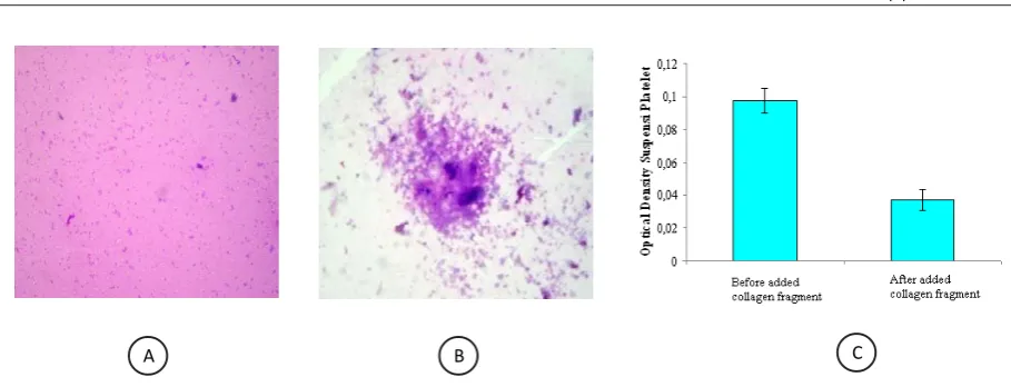Figure 4.Platelet aggregation assay. A. Platelets which incubated with HBSS seem to spread, B
