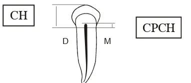 Gambar 2. Pengukuran rasio panjang akar, panjang gigi, lebarpulpa dan lebar akar pada metode Kvaal.3