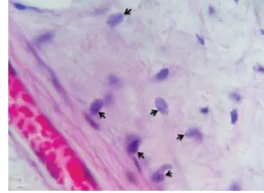 Metode Pemeriksaan Jenis Kelamin Melalui Analisis Histologis Dan DNA ...