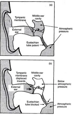 Gambar 2. Gambaran telinga tengah dan telinga luar; (a)  padaketinggian konstan dengan tuba eustachius yangpaten; (b) saat turun dari ketinggian dengan tubaeustachius yang tertutup.