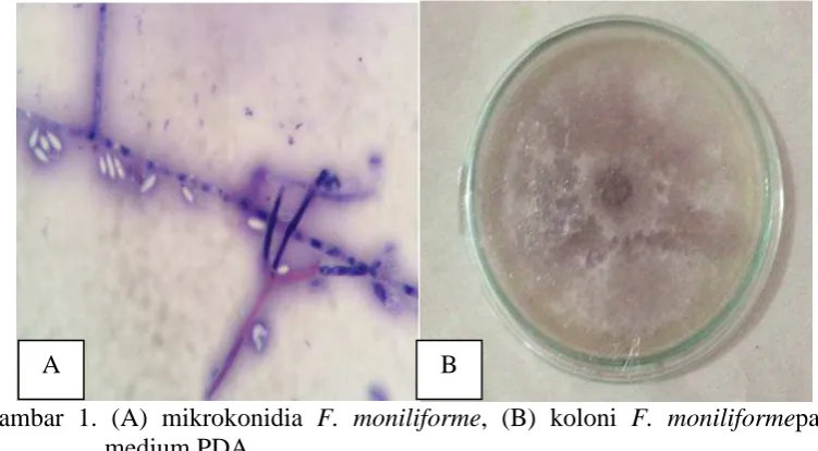 Gambar 1. (A) mikrokonidia  F. moniliforme, (B) koloni F. moniliformepada medium PDA. 