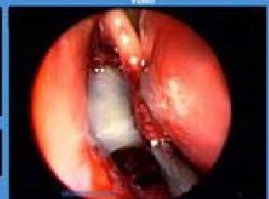 Gambar 10. Pembengkakan pipi pada pasien sinusitis 