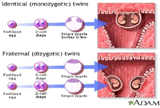 Tabel 1. Jenis multijanin berdasarkan twin pregnancy dan triplet pregnancy. 4