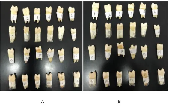 Gambar 2 Warna gigi sebelum perendaman dengan lemon-natrium bikarbonat (A) setelah  perendaman lemon-natrium bikarbonat (B) 