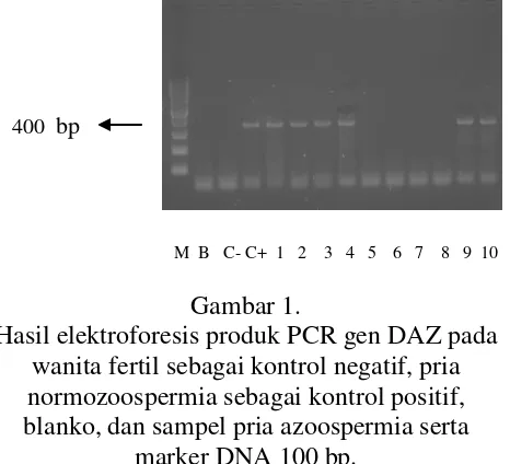 Hasil elektroforesis produk PCR gen DAZ pada Gambar 1. gangguan gen penyandi spermatogenesis (delesi gen DAZ), maka langkah penggunaan teknik 
