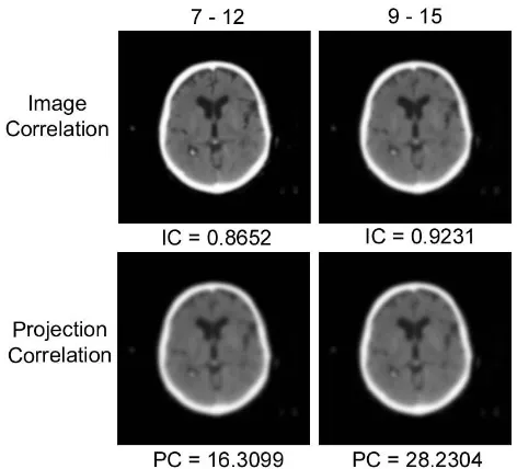 Figure 5. The best reconstruction of brain 