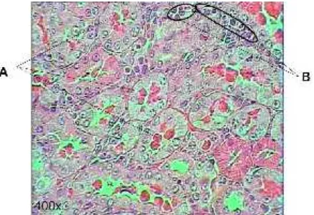 Gambar  7. Hasil pemeriksaan mikroskopis sel ginjal tikus