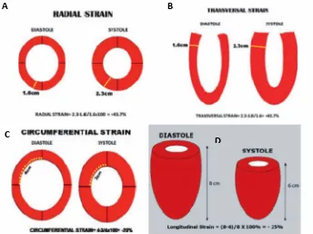 Gambar 3. Jenis-jenis strain: a. strain radial; b. strain transversal; c. strainsirkumferensial dan d