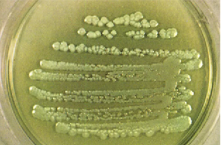 Gambar 3. Koloni Pseudomonas aeruginosa pada agar (Mayasari, 2005). 