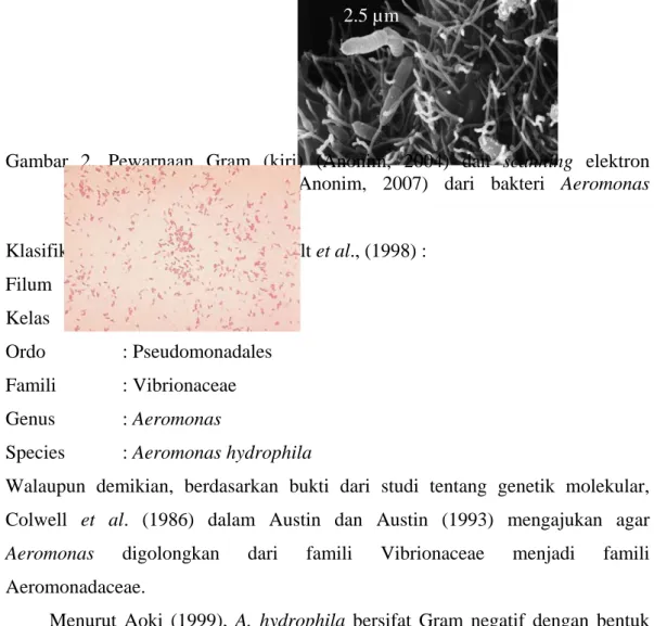 Gambar 2. Pewarnaan Gram (kiri) (Anonim, 2004) dan scanning  elektron  micrograph  (kanan) (Anonim, 2007) dari bakteri Aeromonas  hydrophila 