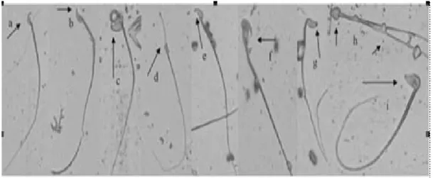 Gambar 2.4.2 Morfologi spermatozoa mencit. (a) spermatozoa normal, (b)  pengait salah membengkok, (c) sperma melipat, (d) kepala terjepit,  (e) pengait pendek, (f) kesalahan ekor sebagai alat tambahan, (g)  tidak ada pengait, (h) sperma berekor ganda denga