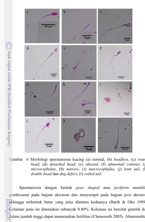 Gambar  6 Morfologi spermatozoa kucing (a) normal, (b) headless, (c) round  head, (d) detached head, (e) abaxial, (f) abnormal contour, (g)  microcephalus, (h) narrow, (i) macrocephalus, (j) bent tail, (k)  double head dan dag defect, (l) coiled tail