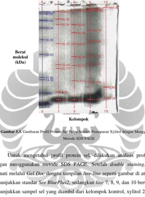 Gambar 5.3. Gambaran Profil Protein Sel Pulpa Setelah Pemaparan Xylitol dengan Menggunakan  Metode SDS PAGE 