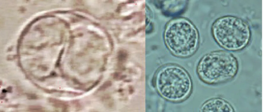 Gambar 7.  Ookista berspora Toxolasma gondii   (Sumber : CDC/ DPDx).